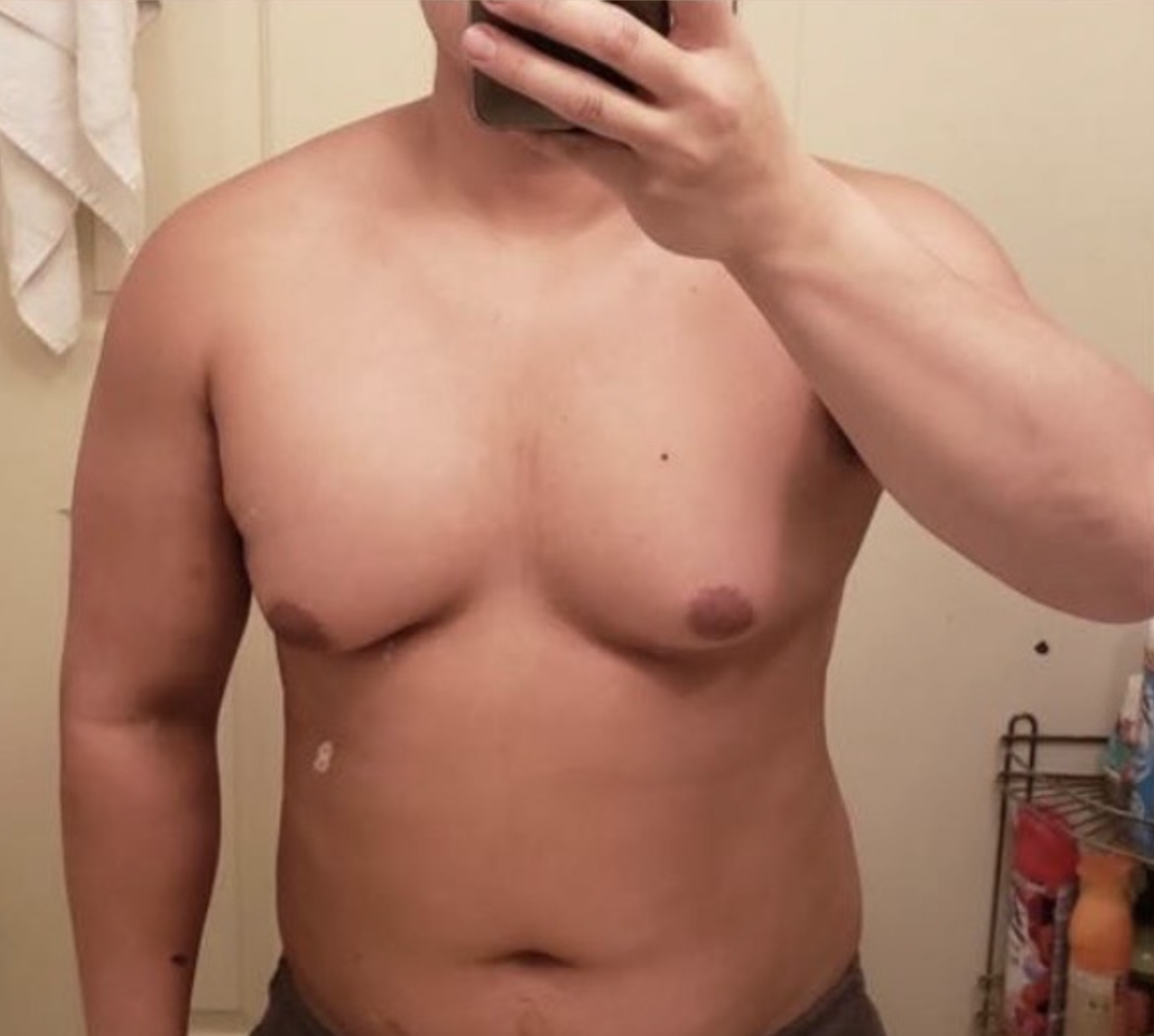 Client before photo