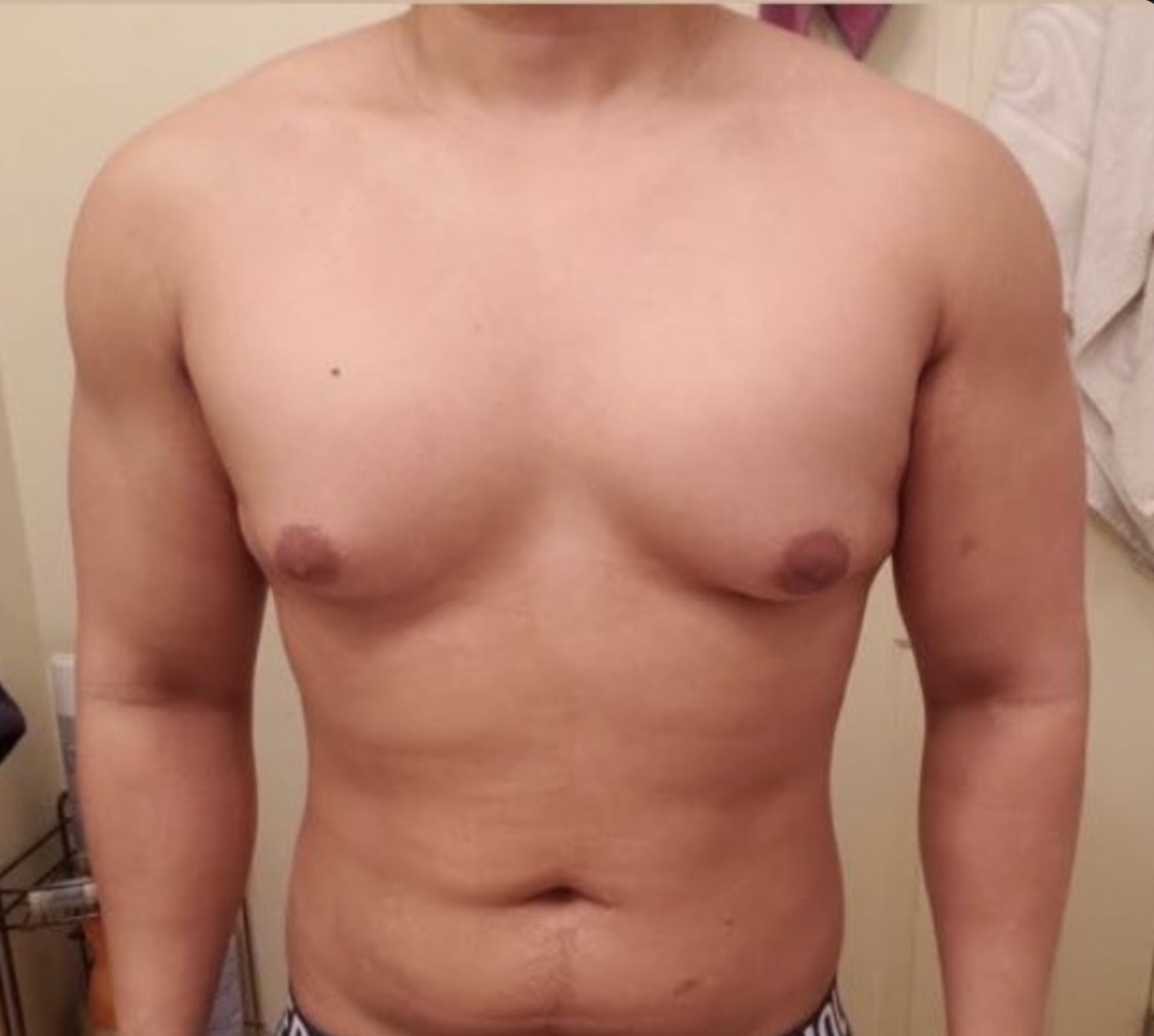 Client after photo