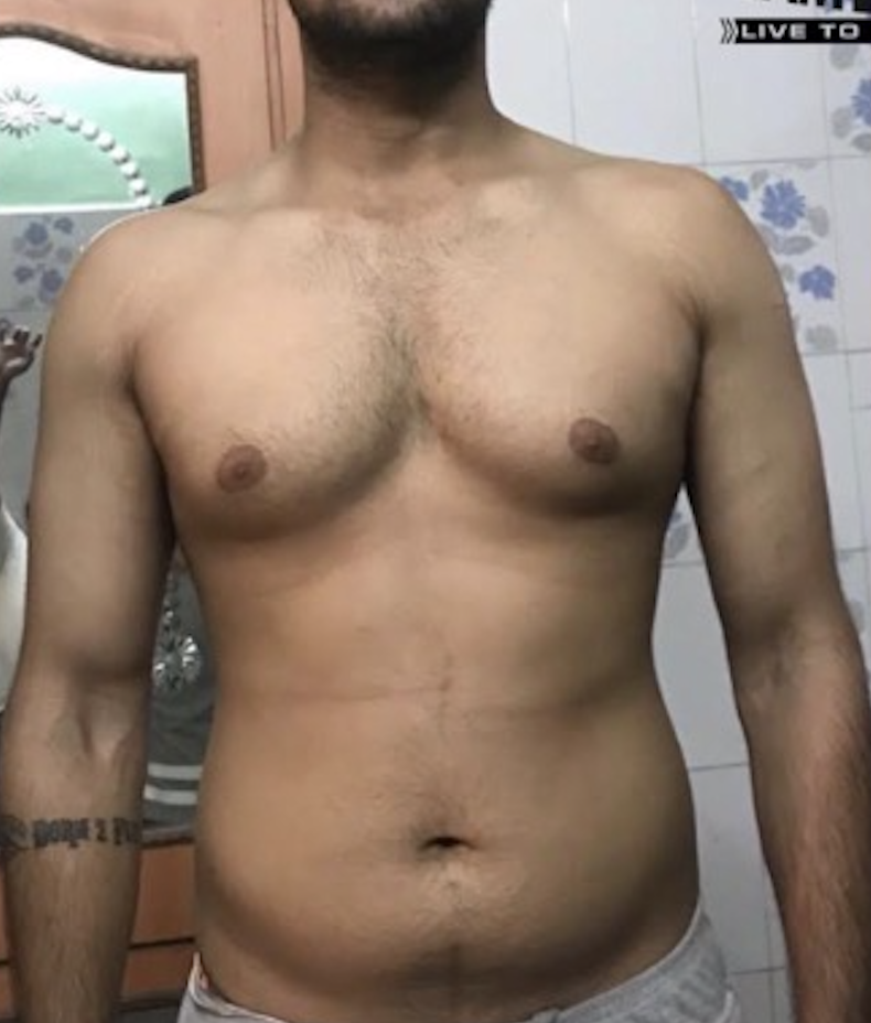 Client before photo