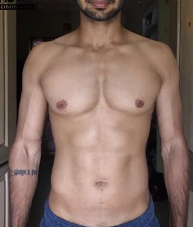 Client after photo