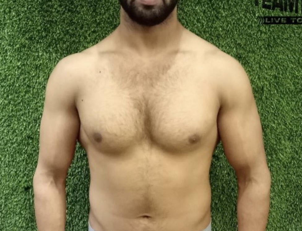 Client before photo