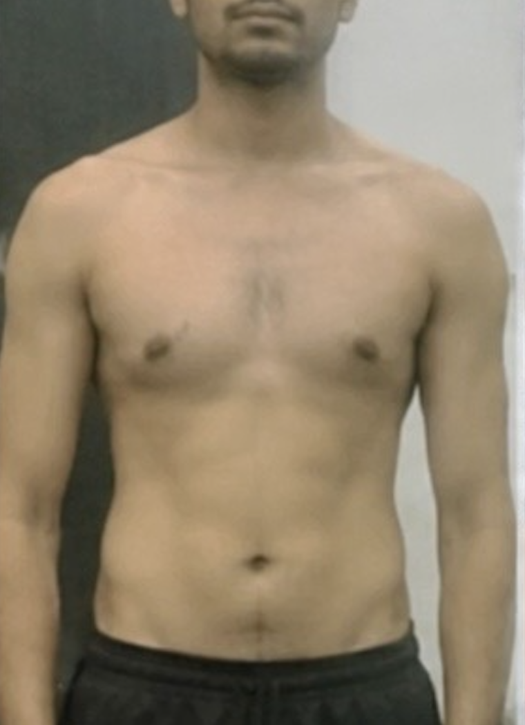 Client before photo