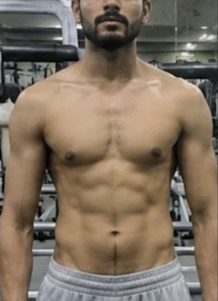 Client after photo