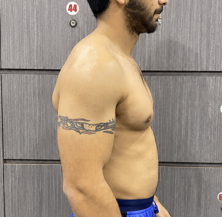 Client before photo