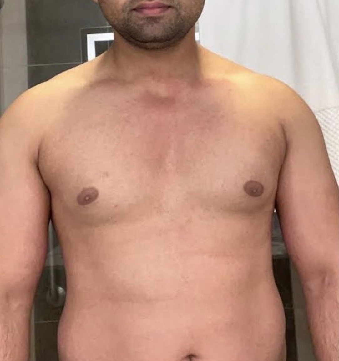 Client before photo