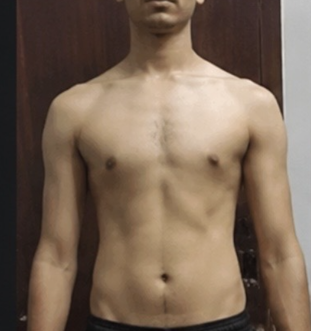 Client before photo