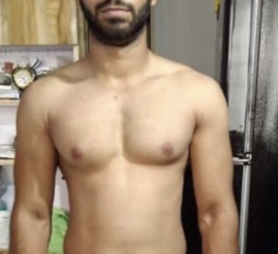Client before photo