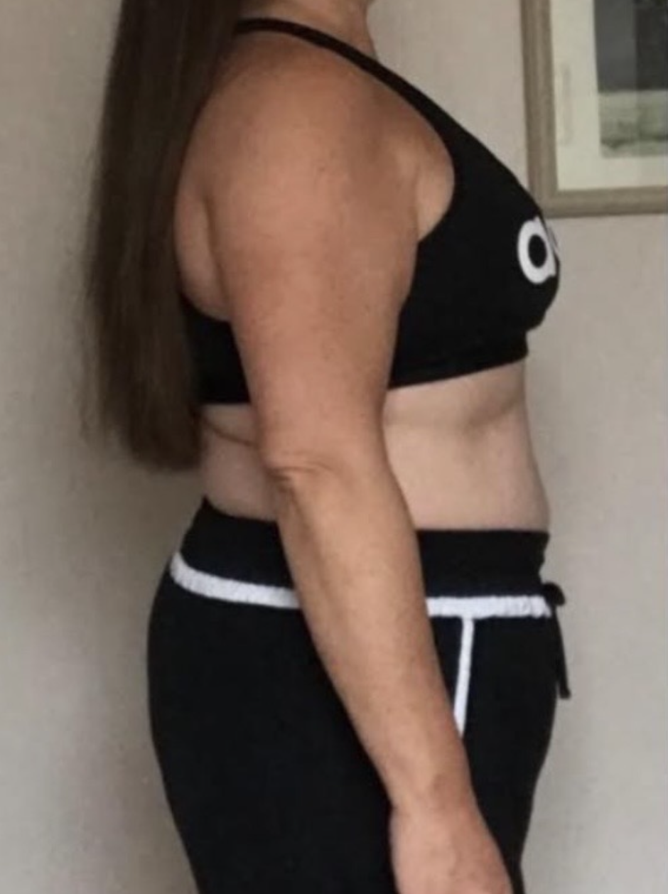 Client before photo