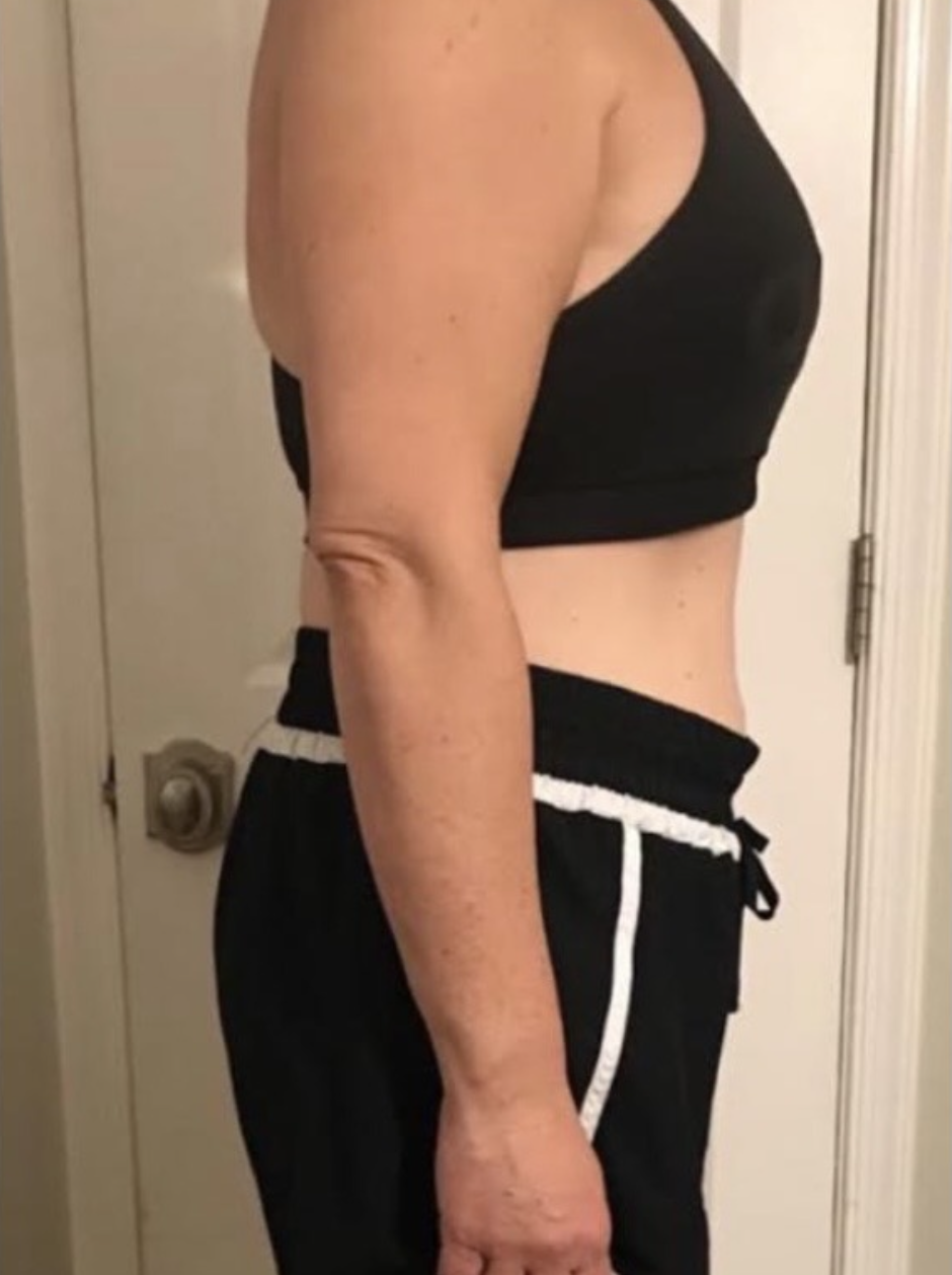 Client after photo
