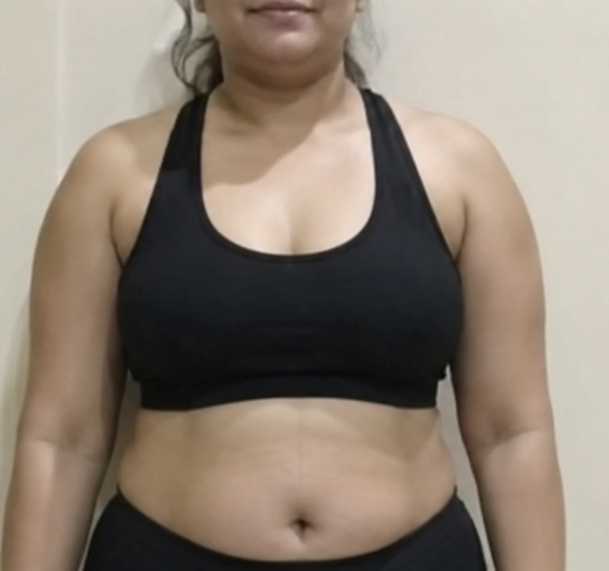Client before photo