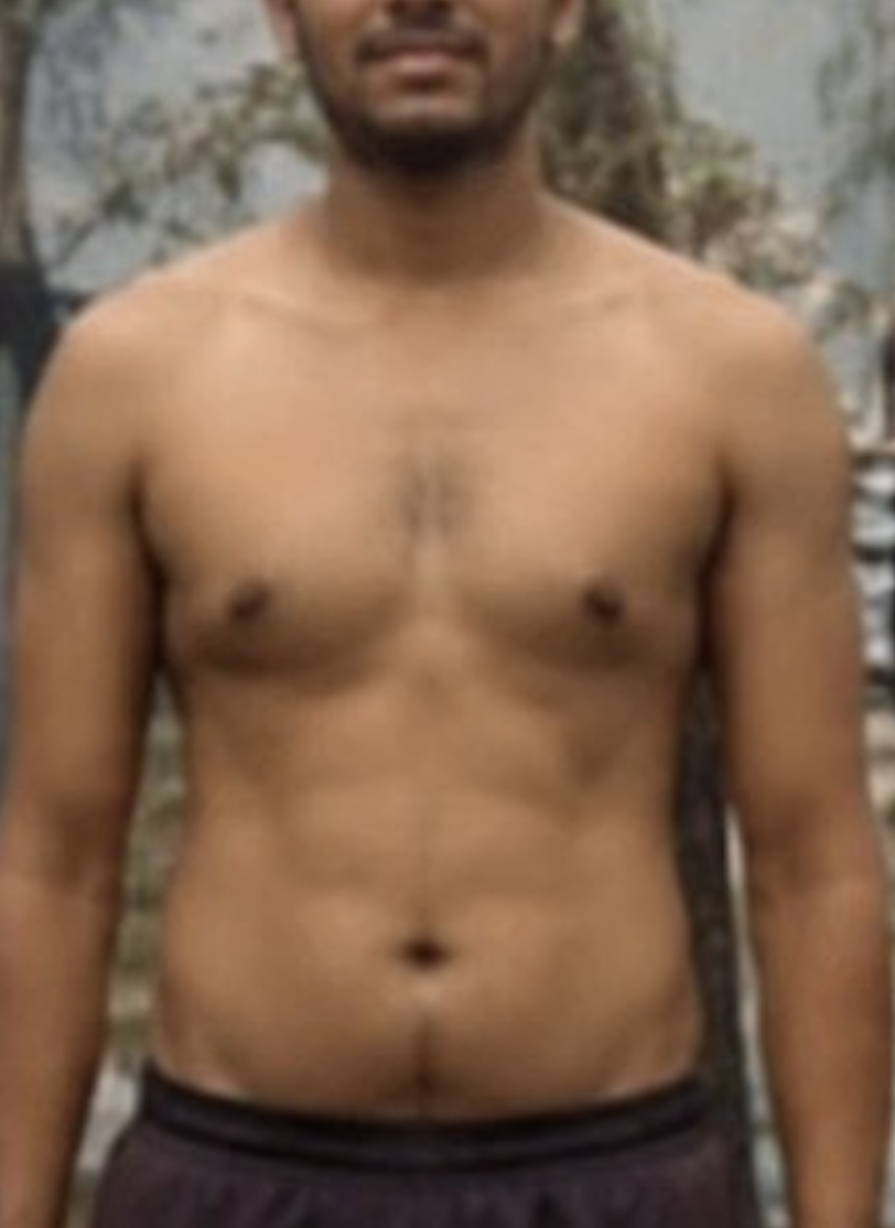 Client before photo