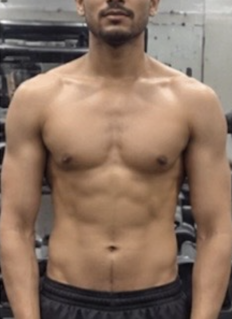 Client after photo