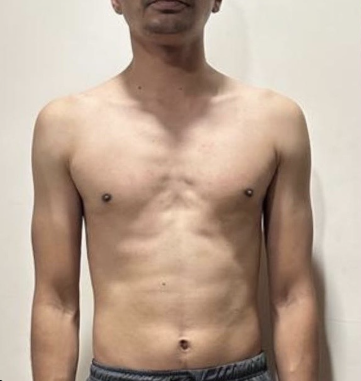 Client before photo